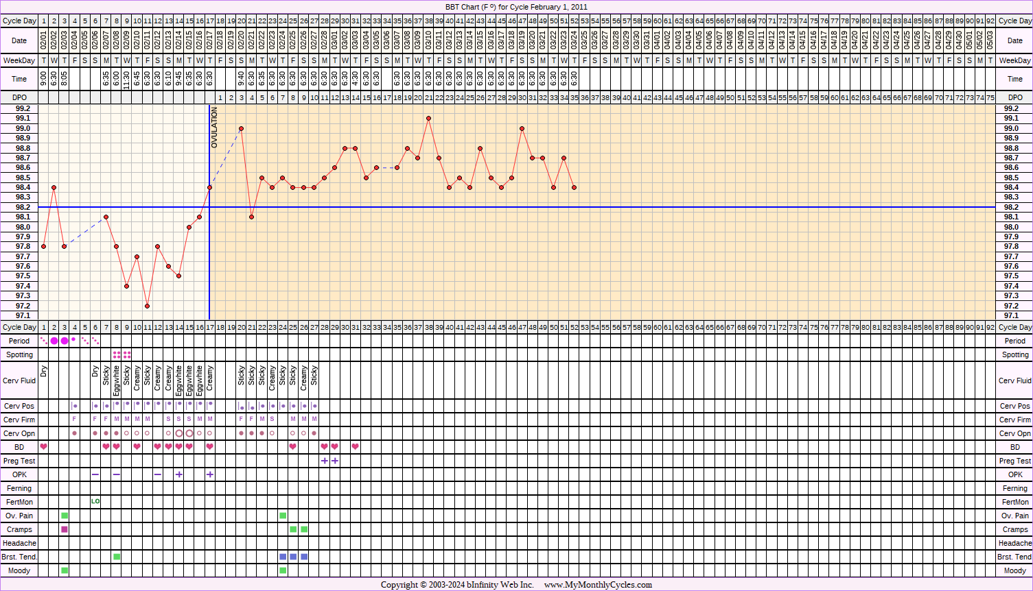 Fertility Chart for cycle Feb 1, 2011, chart owner tags: BFP (Pregnant), Ectopic Pregnancy, Miscarriage